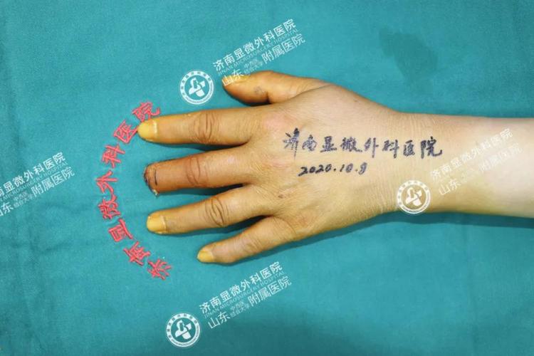 关于球员黄威手术情况通报:手术时间现已确定,计划10月10日进行